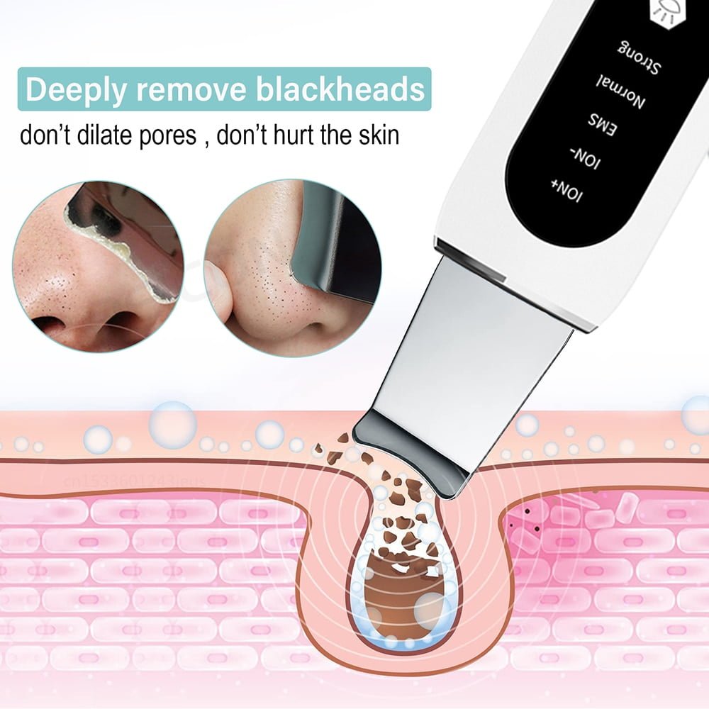 Ultrasonic Skin Peeling and Blackhead Remover Device (Copy) - Image 4