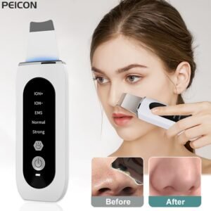 Ultrasonic Skin Peeling and Blackhead Remover Device