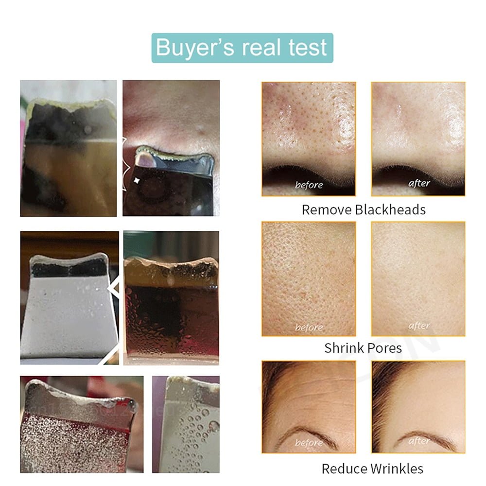 Ultrasonic Skin Peeling and Blackhead Remover Device (Copy) - Image 6
