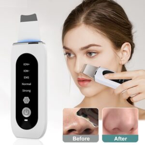 Ultrasonic peeling machine