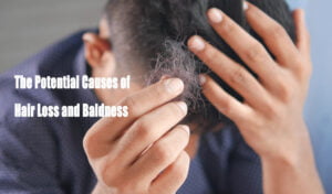 The Potential Causes of Hair Loss and Baldness