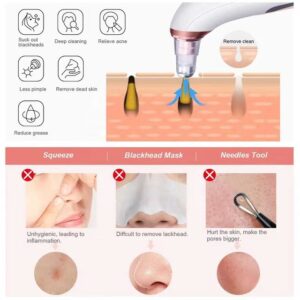 Electric Facial Blackhead Remover